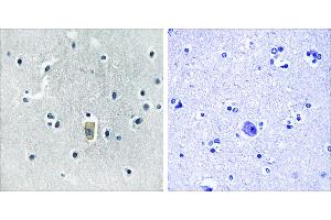 P-peptide - +Immunohistochemistry analysis of paraffin-embedded human brain tissue, using BIM (Phospho-Ser59) antibody. (BIM 抗体  (pSer59))