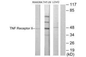 Western Blotting (WB) image for anti-Tumor Necrosis Factor Receptor Superfamily, Member 1B (TNFRSF1B) (C-Term) antibody (ABIN7180270)