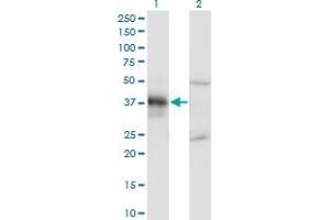 Western Blot analysis of DLX3 expression in transfected 293T cell line by DLX3 monoclonal antibody (M02), clone 3B8. (DLX3 抗体  (AA 1-287))