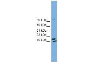 PPIH antibody used at 1 ug/ml to detect target protein. (PPIH 抗体)