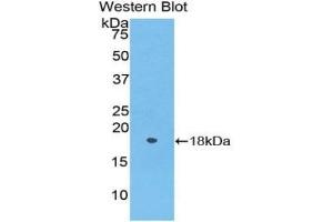 Detection of Recombinant POSTN, Rat using Polyclonal Antibody to Periostin (POSTN) (Periostin 抗体  (AA 24-173))