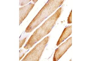 (ABIN6243464 and ABIN6578057) staining Htr2a in mouse skeletal muscle sections by Immunohistochemistry (IHC-P - paraformaldehyde-fixed, paraffin-embedded sections). (HTR2A 抗体  (N-Term))