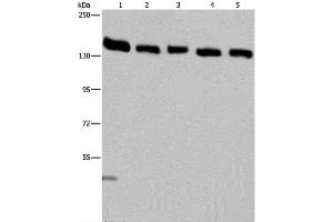 Western Blot analysis of Hela cell and Human testis tissue, A549, Jurkat and K562 cell using IPO4 Polyclonal Antibody at dilution of 1:550 (Importin 4 抗体)