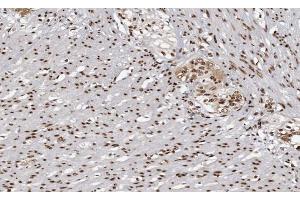 ABIN6266862 at 1/100 staining human Smooth muscle tissue sections by IHC-P. (MAPKAP Kinase 3 抗体  (C-Term))