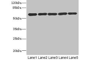 Western blot All lanes: ARHGEF3 antibody at 2. (ARHGEF3 抗体  (AA 287-526))