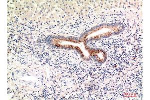 Immunohistochemistry (IHC) analysis of paraffin-embedded Human Liver, antibody was diluted at 1:100. (Complement C4A/C4B (Internal Region) 抗体)