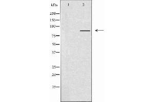 Western blot analysis of extracts from A549 cells using CLCN7 antibody. (CLCN7 抗体  (N-Term))