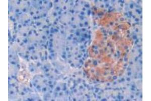 IHC-P analysis of Human Pancreas Tissue, with DAB staining. (SERPINA6 抗体  (AA 218-378))