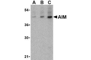 Image no. 1 for anti-CD5 Molecule-Like (CD5L) (C-Term) antibody (ABIN265124) (CD5L 抗体  (C-Term))
