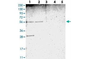 Western blot analysis of Lane 1: RT-4, Lane 2: U-251 MG, Lane 3: Human Plasma, Lane 4: Liver, Lane 5: Tonsil with TMEM180 polyclonal antibody  at 1:250-1:500 dilution. (TMEM180 抗体)