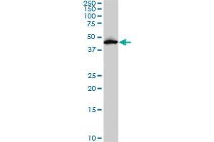 PDK2 monoclonal antibody (M02), clone 5F8. (PDK2 抗体  (AA 187-276))