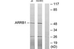 Western blot analysis of extracts from Jurkat/HuvEc cells, using ARRB1 Antibody. (beta Arrestin 1 抗体  (AA 369-418))