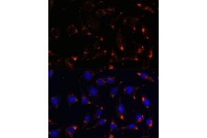 Immunofluorescence analysis of L929 cells using NOS1 antibody (ABIN6129512, ABIN6144725, ABIN6144726 and ABIN6216548) at dilution of 1:100. (NOS1 抗体  (AA 1-180))