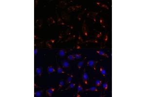 Immunofluorescence analysis of L929 cells using NOS1 antibody (ABIN6129512, ABIN6144725, ABIN6144726 and ABIN6216548) at dilution of 1:100. (NOS1 抗体  (AA 1-180))