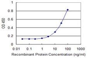 Detection limit for recombinant GST tagged SULT4A1 is 1 ng/ml as a capture antibody. (SULT4A1 抗体  (AA 1-100))