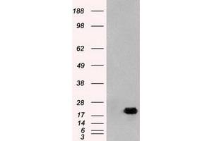 Image no. 1 for anti-Adenylate Kinase 1 (AK1) antibody (ABIN1496516) (Adenylate Kinase 1 抗体)