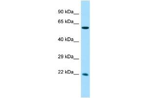 Host: Rabbit Target Name: CCDC85A Sample Type: Fetal Liver lysates Antibody Dilution: 1.