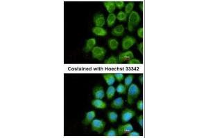 ICC/IF Image Immunofluorescence analysis of methanol-fixed A431, using COX5A, antibody at 1:200 dilution. (COX5A 抗体  (Center))