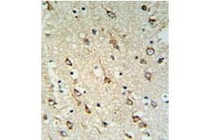 Immunohistochemistry (Paraffin-embedded Sections) (IHC (p)) image for anti-DnaJ (Hsp40) Homolog, Subfamily C, Member 6 (DNAJC6) (AA 260-290), (Middle Region) antibody (ABIN951950)