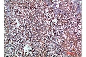 Immunohistochemical analysis of paraffin-embedded human-pancreas, antibody was diluted at 1:200 (CCL2 抗体  (AA 31-80))