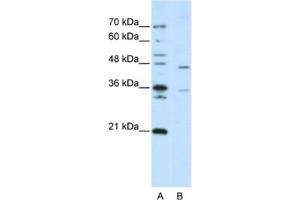 Western Blotting (WB) image for anti-Zinc Finger Protein 488 (ZNF488) antibody (ABIN2462000) (ZNF488 抗体)
