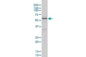 Western Blotting (WB) image for anti-CAMP Responsive Element Binding Protein 5 (CREB5) (AA 1-100) antibody (ABIN599087) (CREB5 抗体  (AA 1-100))