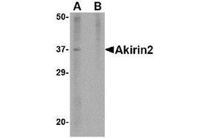 Western blot analysis of Akirin2 in mouse brain tissue lysate with AP30040PU-N Akirin2 antibody at 1 μg/ml in (A) the absence and (B) the presence of blocking peptide. (AKIRIN2 抗体  (Center))