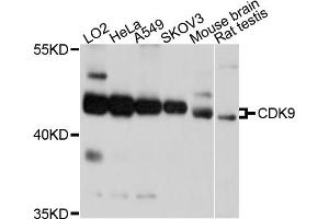 Western blot analysis of extracts of various cell lines, using CDK9 antibody.
