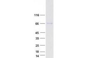 Western Blotting (WB) image for Complement Factor H-Related 5 (CFHR5) protein (Myc-DYKDDDDK Tag) (ABIN2713941)