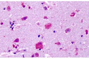 Anti-GPR83 antibody IHC staining of human brain, cortex, neurons. (GPR83 抗体  (Extracellular Domain))