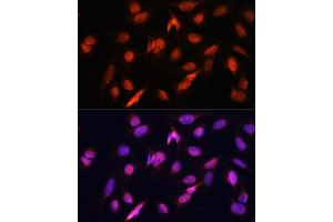 Immunofluorescence analysis of U2OS cells using OTUB1 antibody (ABIN6128400, ABIN6145086, ABIN6145088 and ABIN6215346) at dilution of 1:100. (OTUB1 抗体  (AA 1-220))