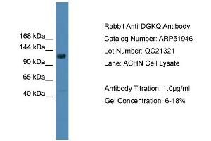WB Suggested Anti-DGKQ  Antibody Titration: 0. (DGKQ 抗体  (Middle Region))