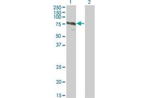 Western Blot analysis of ZYX expression in transfected 293T cell line by ZYX monoclonal antibody (M01), clone 2C10-4A7. (ZYX 抗体  (AA 1-572))