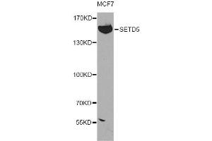 Western blot analysis of extracts of MCF-7 cells, using SETD5 antibody (ABIN4905135) at 1:300 dilution. (SETD5 抗体)