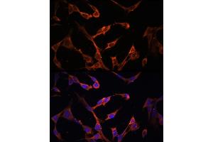 Immunofluorescence analysis of NIH/3T3 cells using HLA-DPB1 antibody (ABIN7268370) at dilution of 1:100. (HLA-DPB1 抗体)