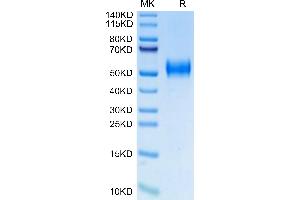 Plasminogen Activator, Urokinase Receptor (PLAUR) (AA 23-305) protein (His-Avi Tag,Biotin)