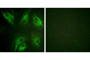 P-peptide - +Immunofluorescence analysis of HeLa cells, using Calsenilin/KCNIP3 (Phospho-Ser63) antibody. (DREAM 抗体  (pSer63))