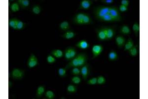 Immunofluorescence staining of Hela cells with ABIN7171794 at 1:266, counter-stained with DAPI. (TES 抗体  (AA 130-260))