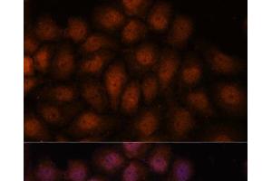 Immunofluorescence analysis of HeLa cells using IPO8 Polyclonal Antibody at dilution of 1:100. (Importin 8 抗体)