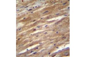 Immunohistochemistry analysis in formalin fixed and paraffin embedded mouse heart tissue reacted with FSD2 Antibody (N-term) followed by peroxidase conjugation of the secondary antibody and DAB staining. (FSD2 抗体  (N-Term))