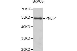 Western blot analysis of extracts of BxPC-3 cells, using PNLIP antibody (ABIN5975718) at 1/1000 dilution. (PNLIP 抗体)