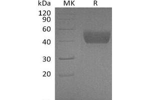 Follistatin-Like 1 (FSTL1) protein (His tag)