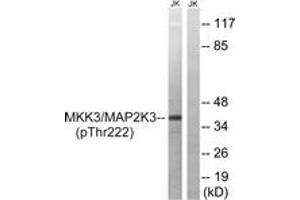 Western blot analysis of extracts from Jurkat cells treated with serum 20% 15', using MAP2K3 (Phospho-Thr222) Antibody. (MAP2K3 抗体  (pThr222))