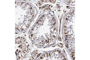 Immunohistochemical staining of human testis with ALG1L polyclonal antibody  shows strong cytoplasmic positivity in Sertoli and Leydig cells at 1:50-1:200 dilution. (ALG1L 抗体)