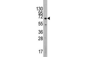 Western blot analysis of MAPK4 antibody and Jurkat lysate. (MAPK4 抗体  (AA 537-566))