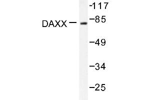 Image no. 1 for anti-Death-Domain Associated Protein (DAXX) antibody (ABIN271883) (DAXX 抗体)