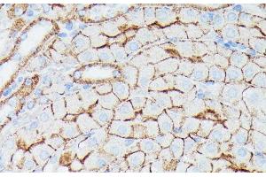 Immunohistochemistry of paraffin-embedded Mouse kidney using IFITM1 Polyclonal Antibody at dilution of 1:100 (40x lens). (IFITM1 抗体)