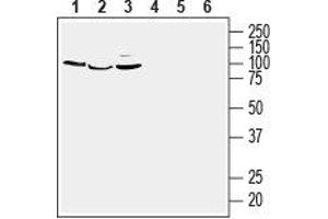 Western blot analysis of human  breast adenocarcinoma (lanes 1 and 4), human  monocytic leukemia (lanes 2 and 5) and human Jurkat T-cell leukemia (lanes 3 and 6) cell line lysates:1-3. (G Protein-Coupled Estrogen Receptor 1 (GPER) Peptide)