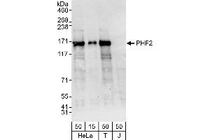 Western Blotting (WB) image for anti-PHD Finger Protein 2 (PHF2) (AA 650-700) antibody (ABIN7453161)