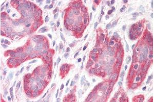 ABIN185168 (3. (PDLIM4 抗体  (C-Term))